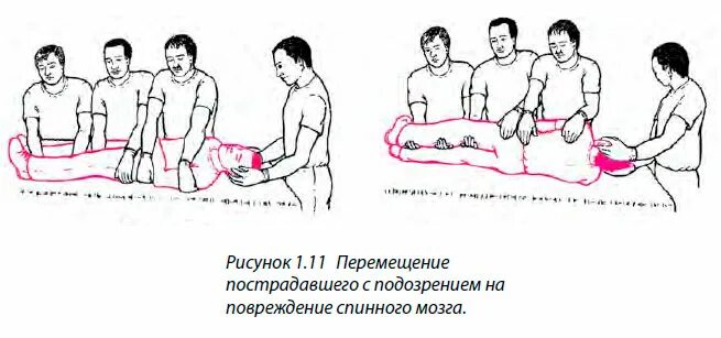 Пострадавший с подозрением на травму позвоночника. Перемещение при травме позвоночника. Перекладывание пациента на носилки с травмой позвоночника. Перемещение пострадавшего с травмой шеи.