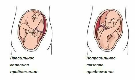 Как понять по животу как лежит ребенок