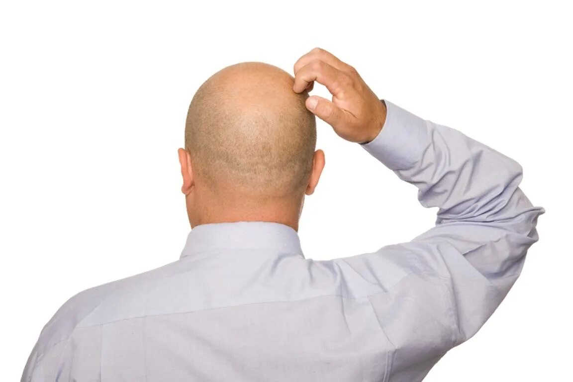 Капитан фейспалм. Фейспалм греческая скульптура. Рука голова как называется. Жесты руками. Капитан пикард facepalm.