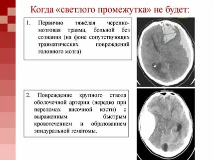 Светлый промежуток