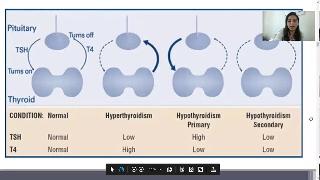 Тироксин гормон. Thyroid т3. Secondary hypothyroidism. Тест tsh3.