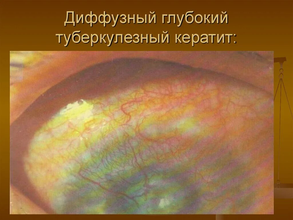 Диффузная область