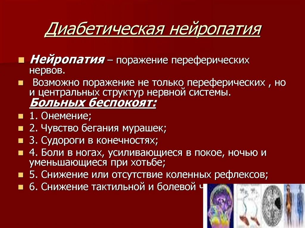 Диабетическая нейропатия. Деабетическаянейропатия. Диабетическая полиневропатия. Диабетическая периферическая нейропатия.