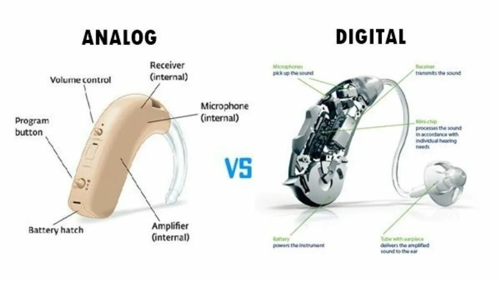 Hearing fix. Слуховой аппарат Digitrim 12p. Слуховой аппарат Соната у-28. Слуховой аппарат Sonata у-01. Слуховые аппараты Октава у-03.