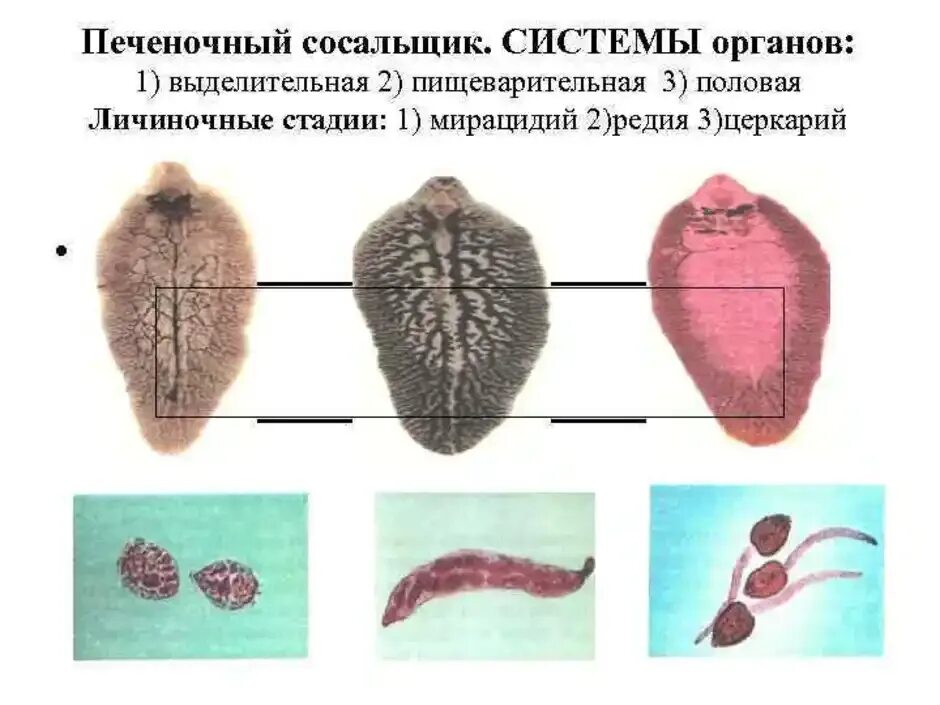 Выделительная система сосальщиков червей. Фасциола выделительная система. Пищеварительная система печеночного сосальщика препарат. Класс сосальщики выделительная система. Выделение сосальщиков