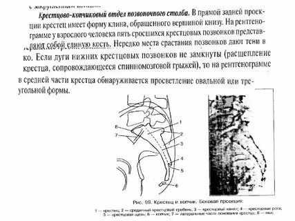 Лечение артроза копчикового сочленения