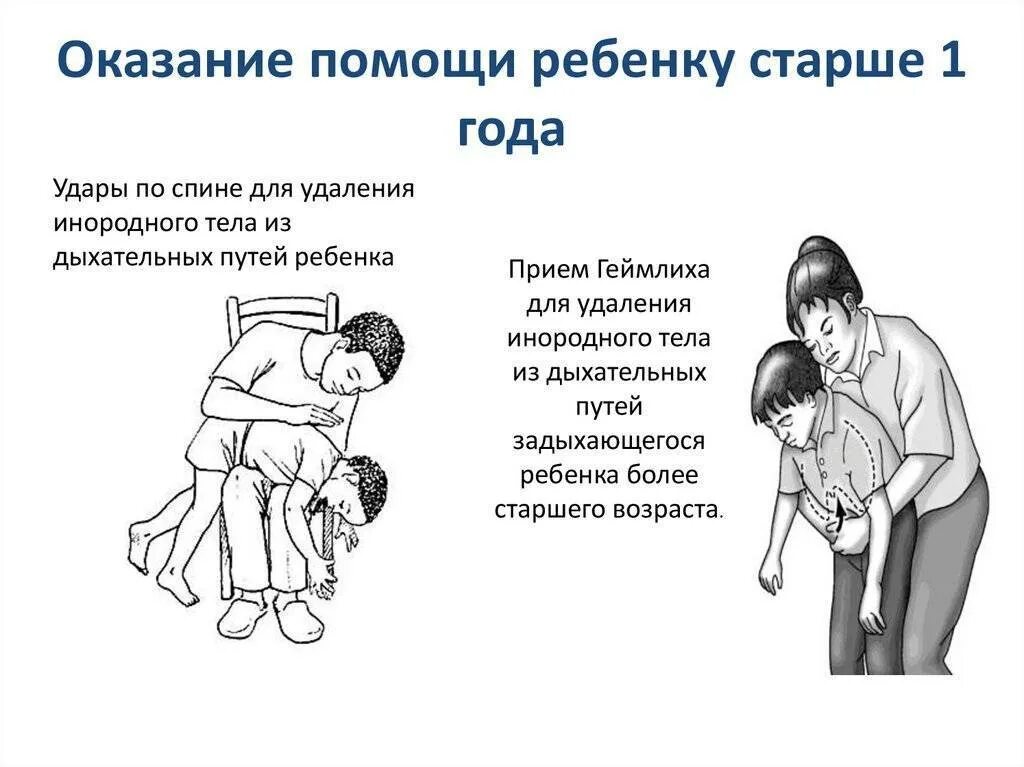 1 помощь при закупорке дыхательных путей