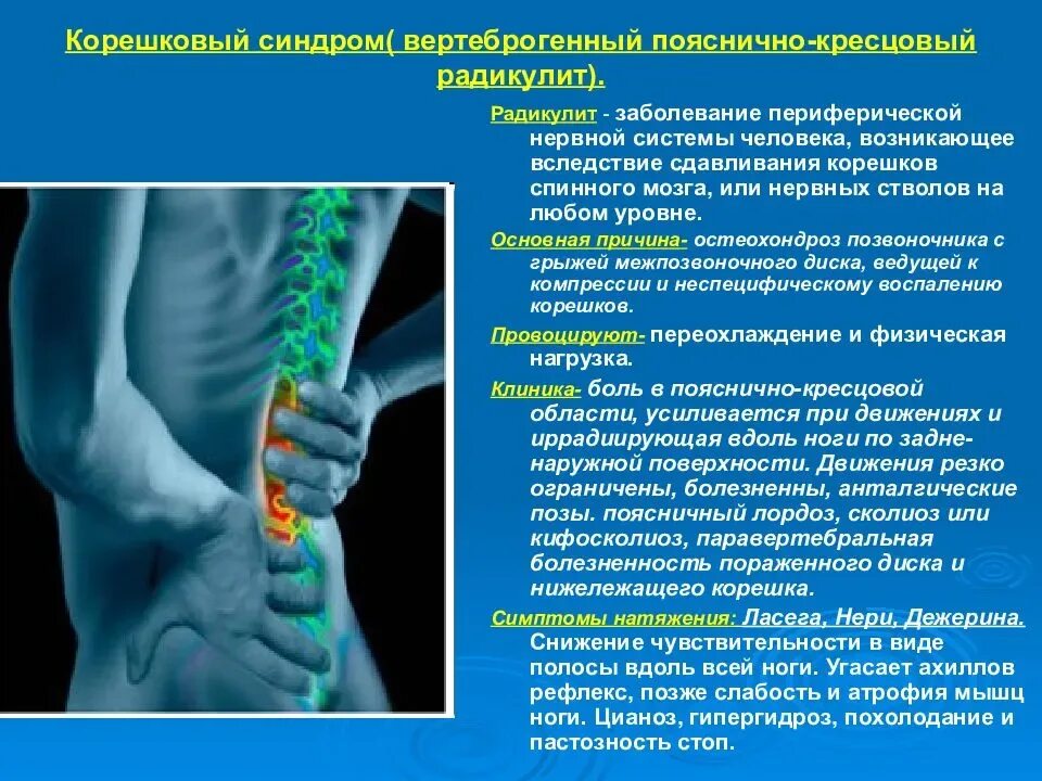 Боли в пояснице остеохондроз. Остеохондроз грудного отдела позвоночника патогенез. Корешковый синдром l5. Синдромы при остеохондрозе поясничного отдела позвоночника. Компрессия s1 корешка позвоночника..