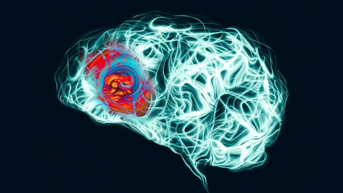 Мозг магнитное поле. Stimulates the Brain РВ. Small Brain.