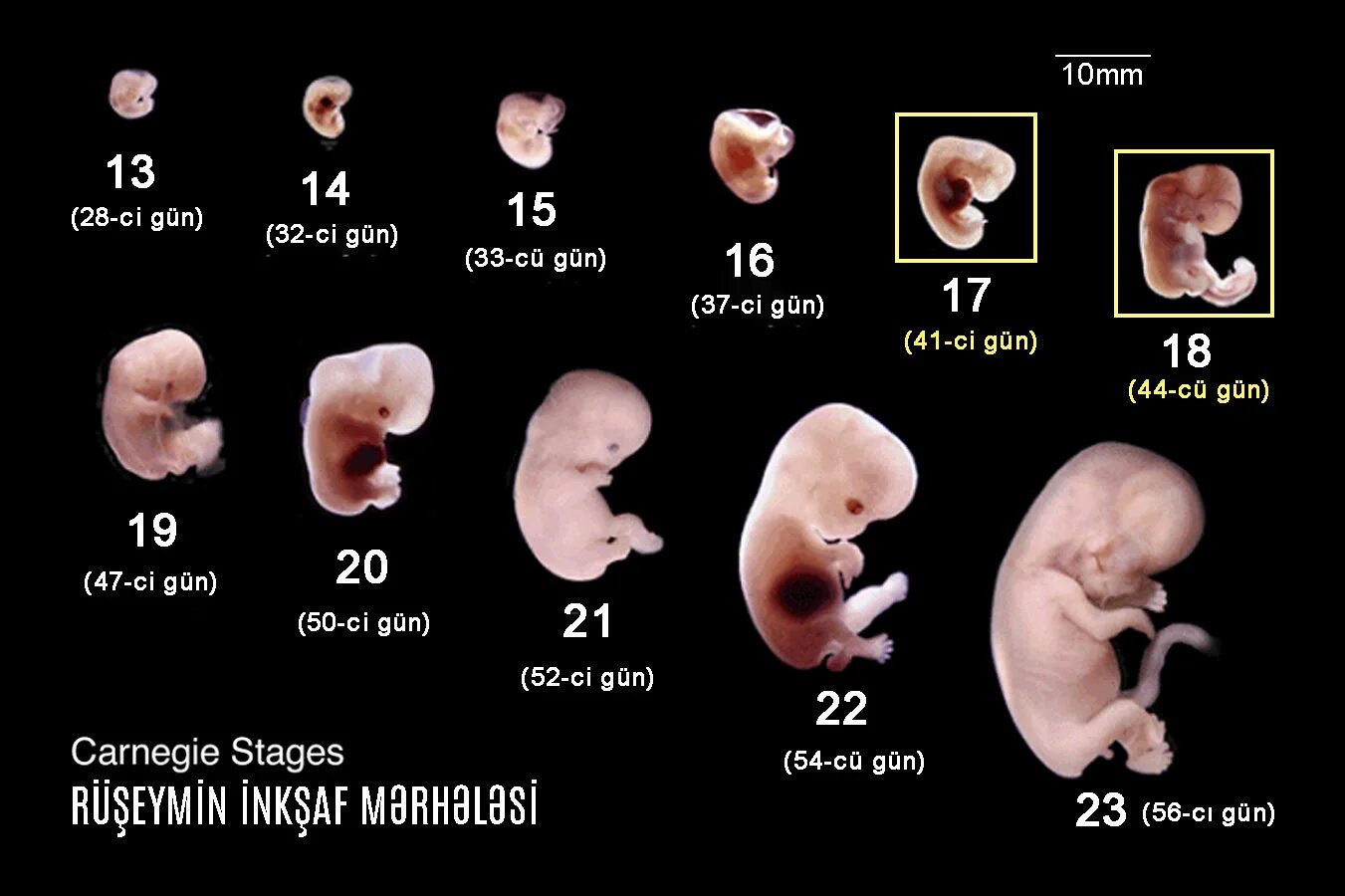 Эмбрион 3 мм как выглядит. Размер человеческого эмбриона в 6 недель. Эмбрион 4 недели размер эмбриона.