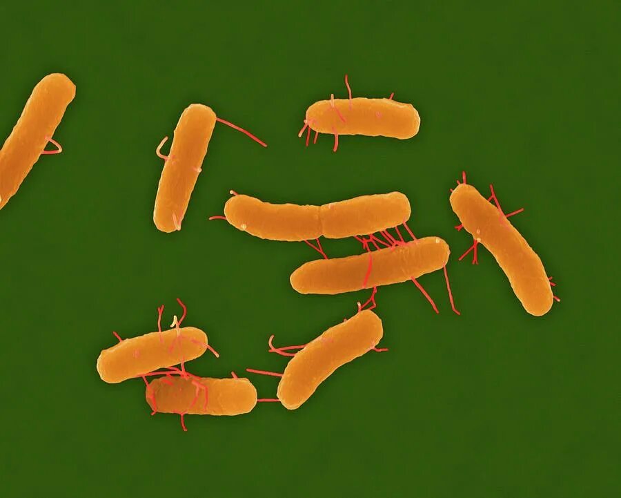 Salmonella Enteritidis сальмонелла Тип дыхания. Бактерия сальмонелла Тифи. Salmonella Enteritidis Тип дыхания. Сальмонелла энтеридитис микроскопия. Сальмонеллез бактерия