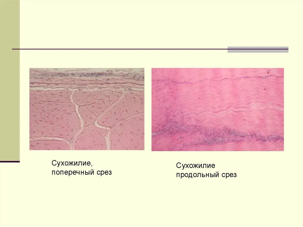 Поперечный и продольный срез. Плотная соединительная ткань сухожилия препарат. Плотная волокнистая оформленная соединительная поперечный срез. Плотная оформленная соединительная ткань гистология поперечный срез. Плотная оформленная соединительная ткань продольный срез сухожилия.