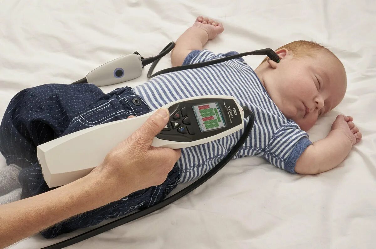 Прибор отоакустической эмиссии. Аудиологический скрининг слуха у детей. Аудиологический скрининг новорожденных. Отоакустическая эмиссия (ОАЭ). Аппарат отоакустической эмиссии для новорожденных.