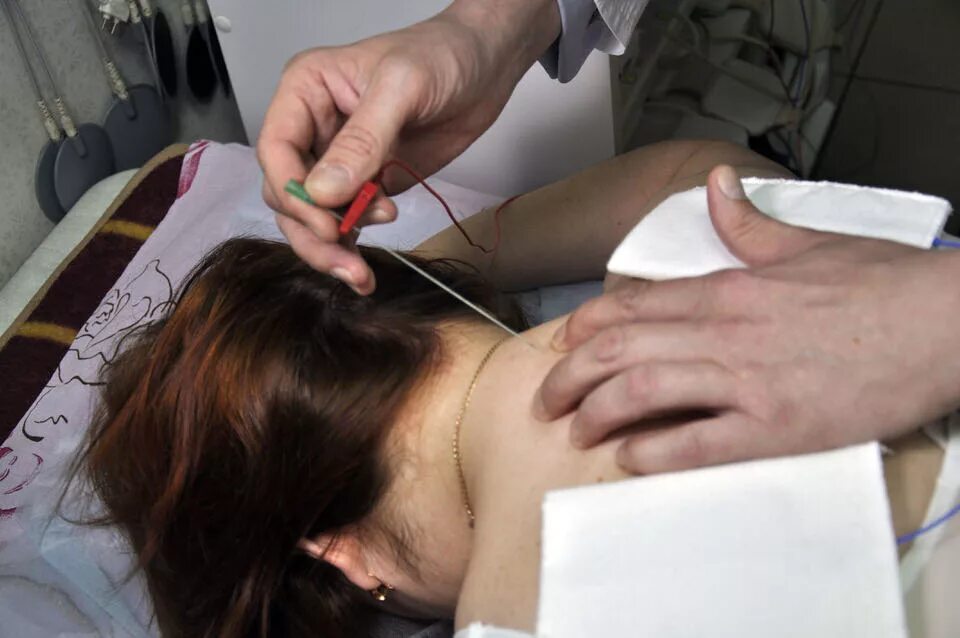 Аппарат для внутритканевой электронейростимуляции. Метод герасимова внутритканевая. Втэс по герасимову. Втэс внутритканевая электростимуляция. Втэс по герасимову.