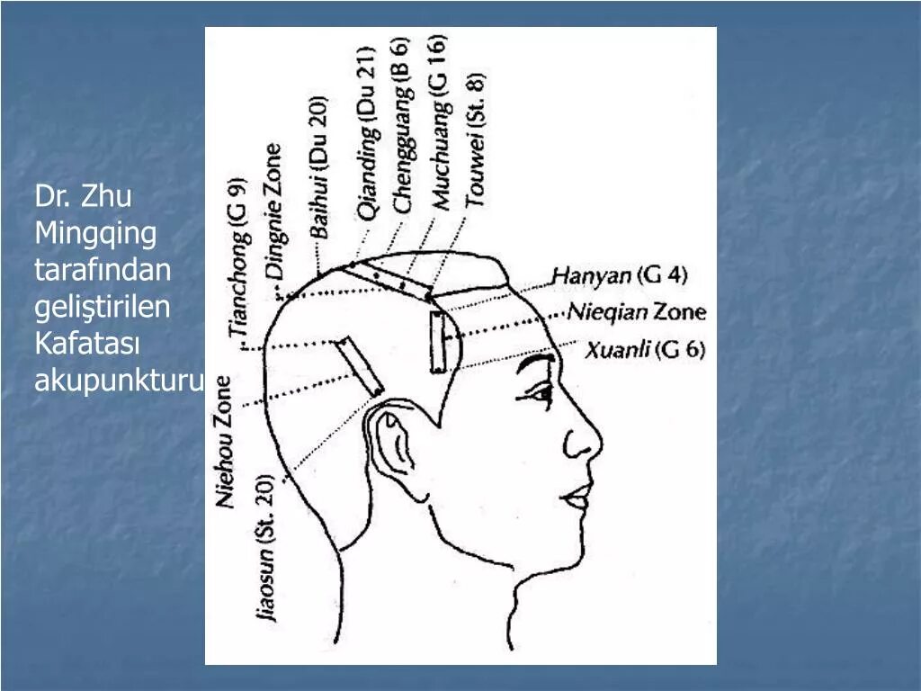 Затылок схема. 32 Точки на голове бары схема. Точки бары на голове схема русском. 32 Точки на голове бары схема на русском для самостоятельной работы. Zhus Scalp Acupuncture.