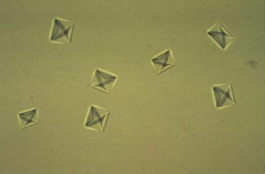 Оксалаты кальция в моче микроскопия. Кристаллы оксалата кальция микроскопия. Оксалат кальция под микроскопом. Оксалаты кальция в моче под микроскопом. Кристаллы оксалата в моче у мужчин