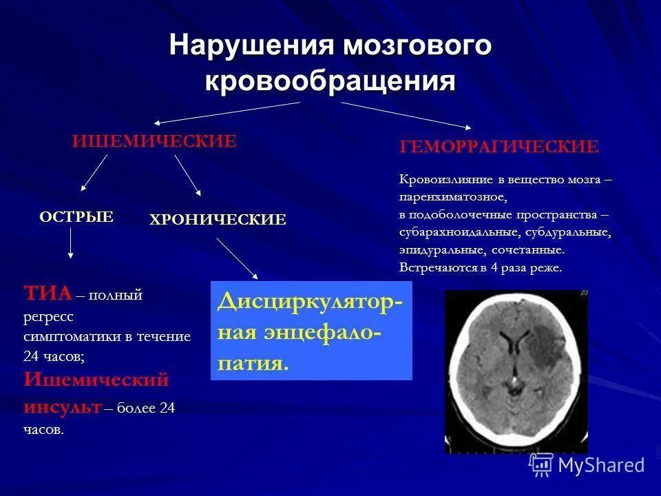 Нарушение мозгового кровообращения. Нарушение кровообращения головного мозга. Острые и хронические нарушения мозгового кровообращения. Типы нарушения мозгового кровообращения.