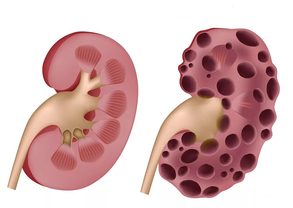 влияние алкоголя на органы мочевыделительной системы. влияние табакокурения на дыхательную систему организма человека. влияние алкоголя на работу почек. орган строение функции почки. влияние алкоголя на почки презентация.