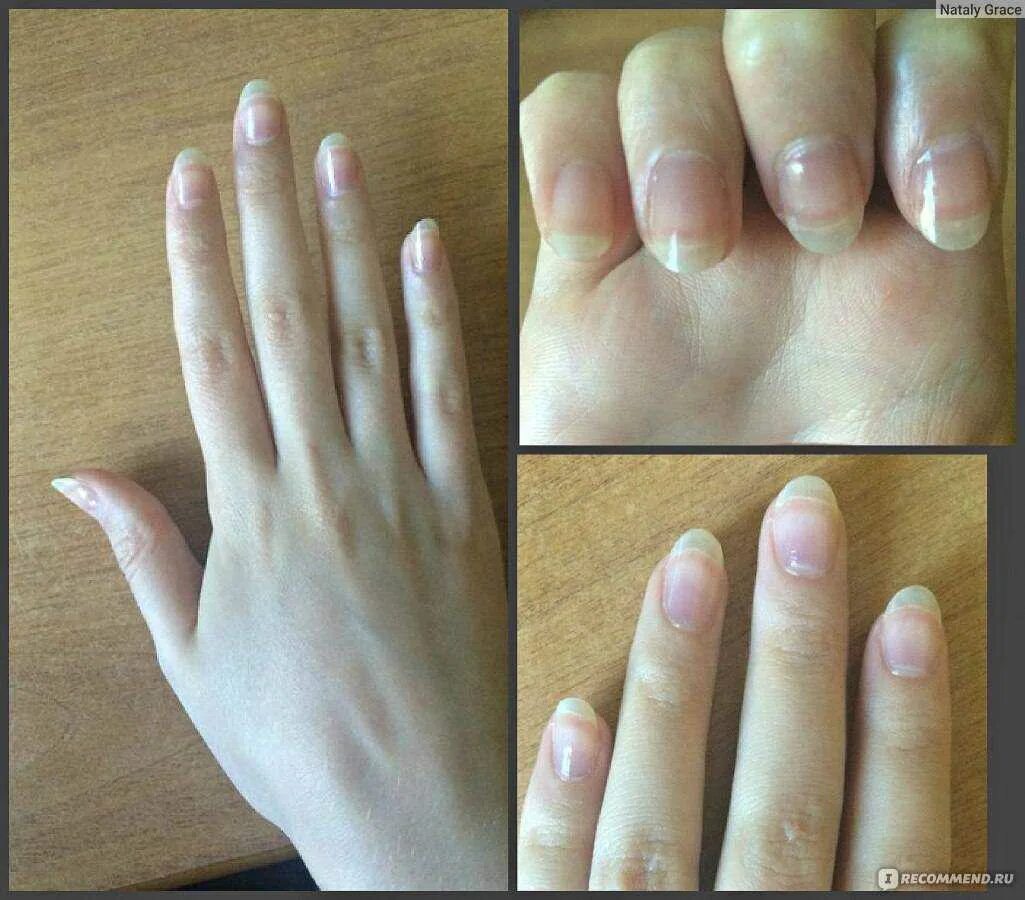 Отбелить ногти. Отбеливающий карандаш для ногтей. Как отбелить ногти на руках. Прозрачный лак для ногтей от желтизны. Белый карандаш для французского маникюра.