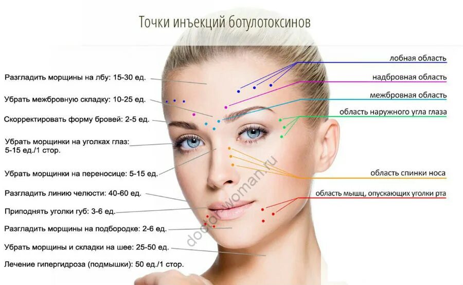 Колоть от морщин. Схема введения ботокса. Схема уколов ботокса. Схема ботокса на лице. Схема введения ботокса на лице.