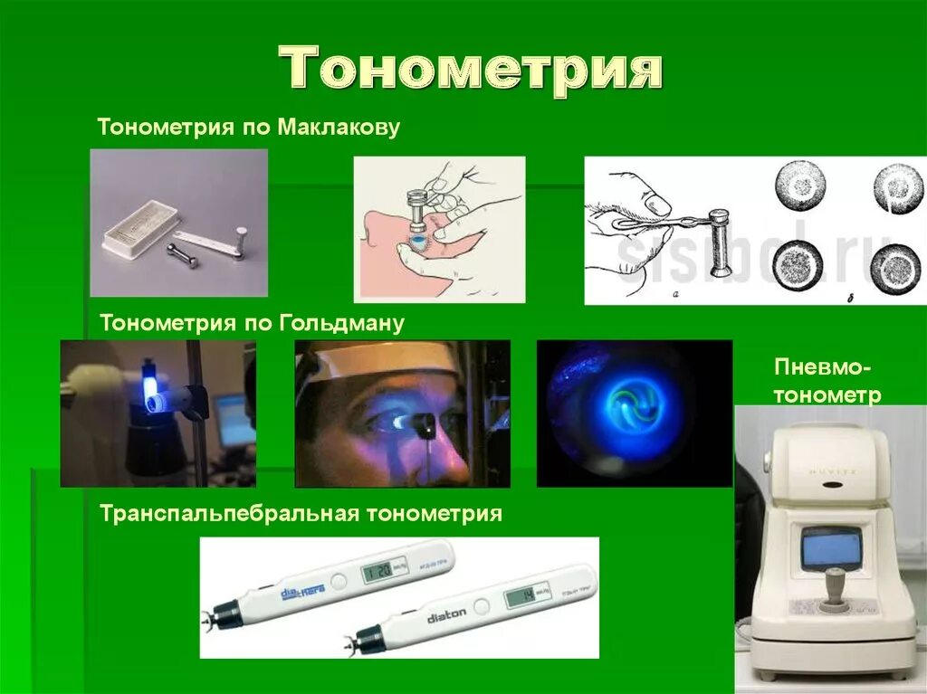 Определение внутриглазного давления по маклакову. Алгоритм тонометрия (измерение внутриглазного давления). метод измерения внутриглазного давления по маклакову. тонометр гольдмана для измерения глазного давления. тонометрия глаза алгоритм.