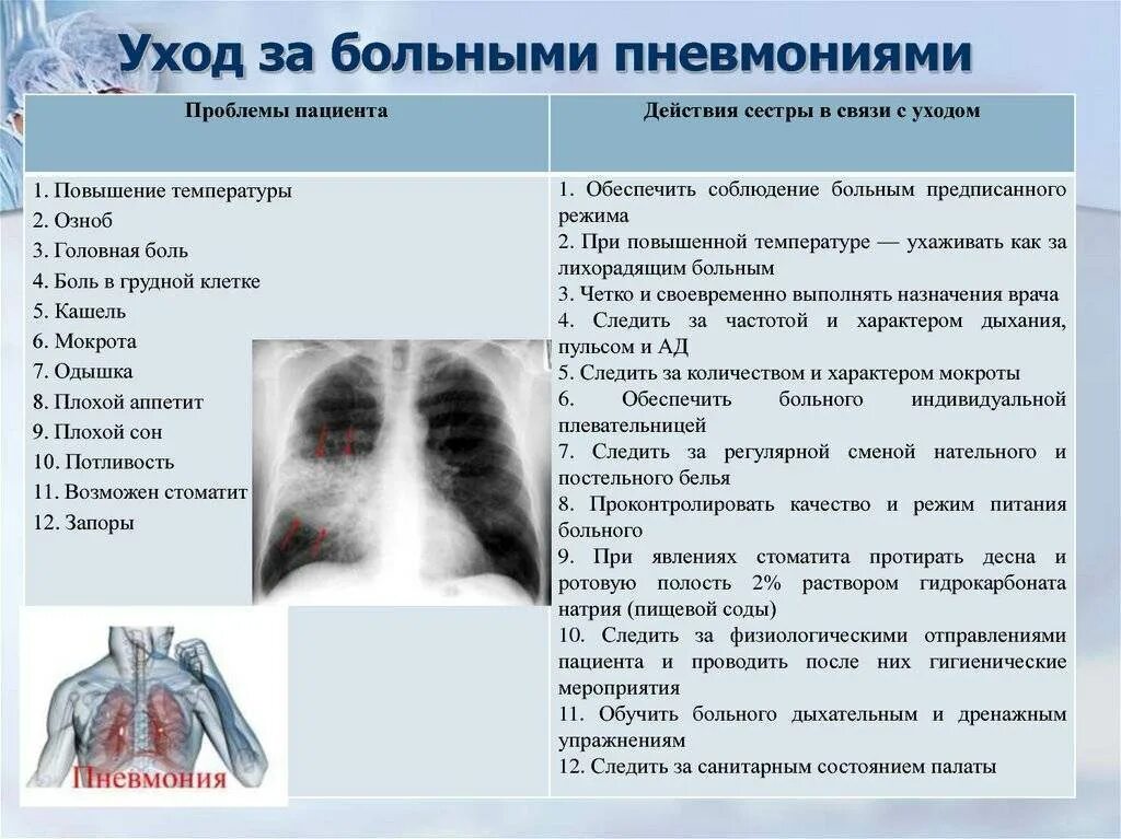 Лечение поражения легких