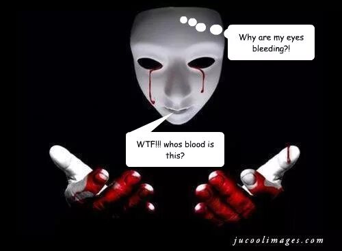 центральная гетерохромия карих глаз. сходящееся косоглазие. This is eyes. Crazy eyes. глаза.