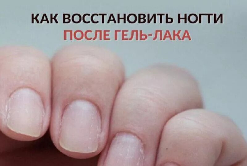 Что делать с ногтями после. Восстановление ногтей после гель лака. Слоятся ногти после гель лака.