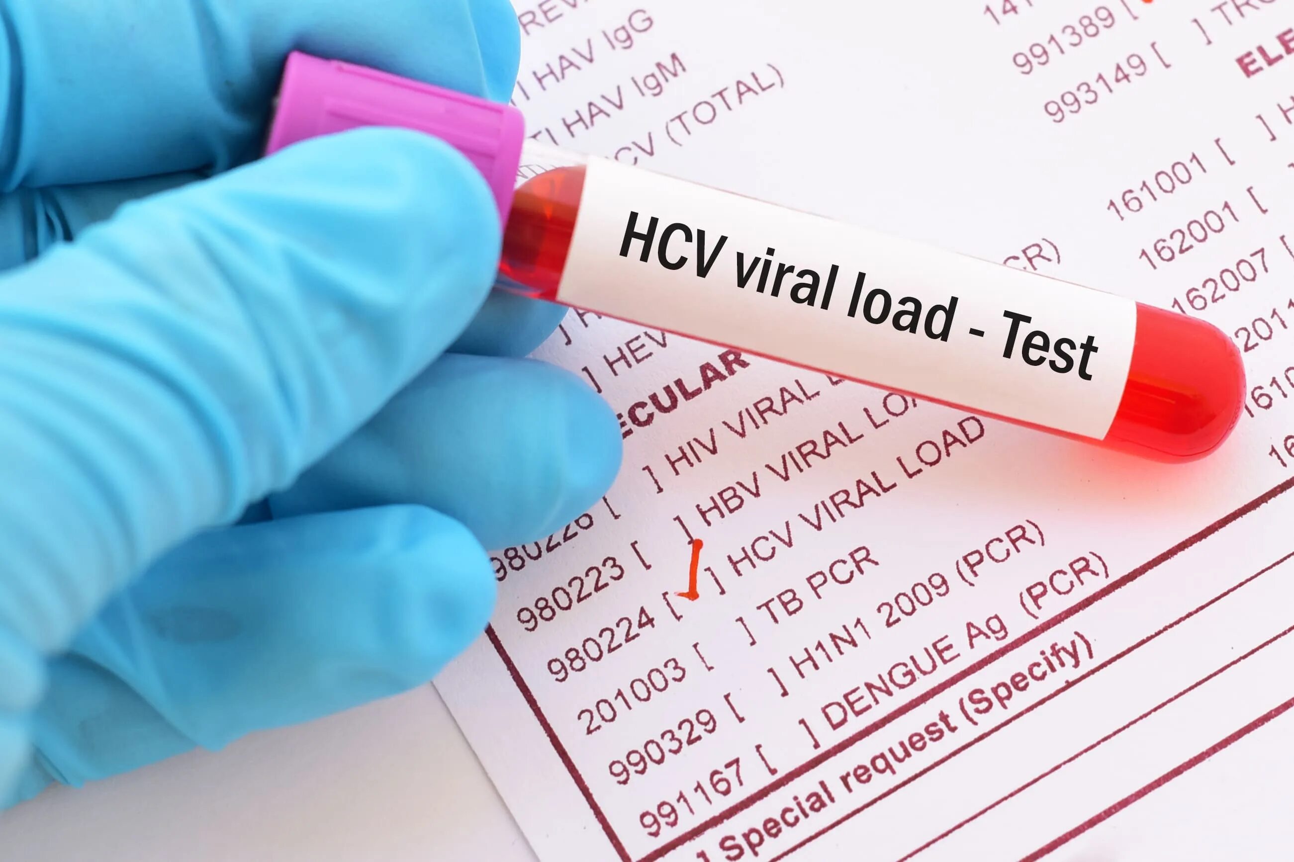 Viral load Test. HCV. Вирусная кровь картинка для конспекта. Картинка для пробы превью. Исследование hcv