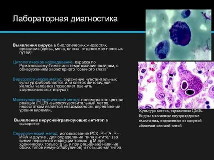 Иммуноглобулина токсоплазмоз