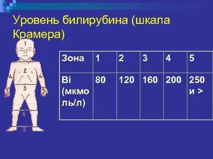 Показатели желтухи у новорожденных
