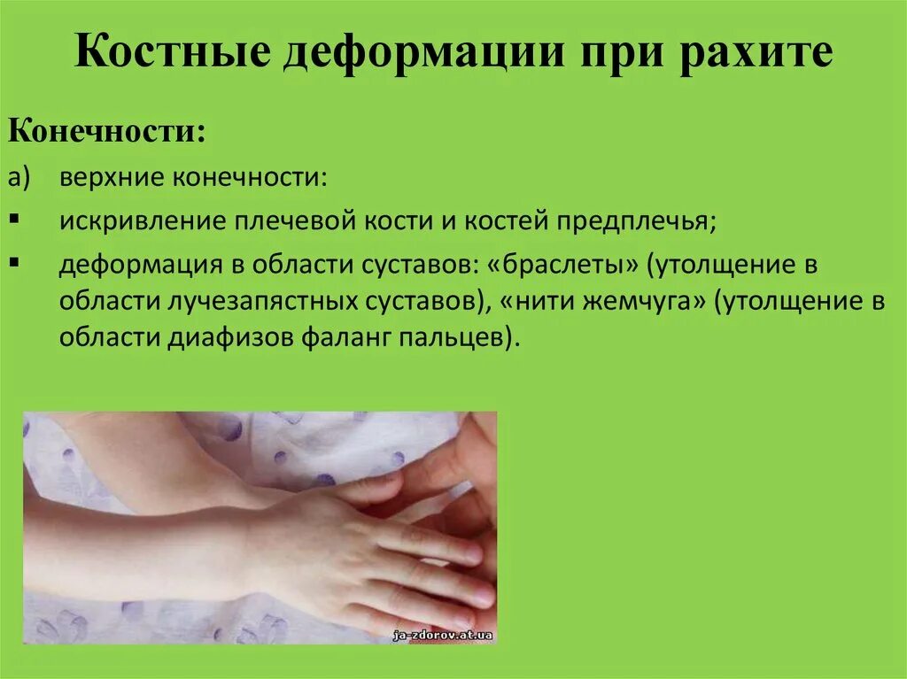 Питание больного рахитом