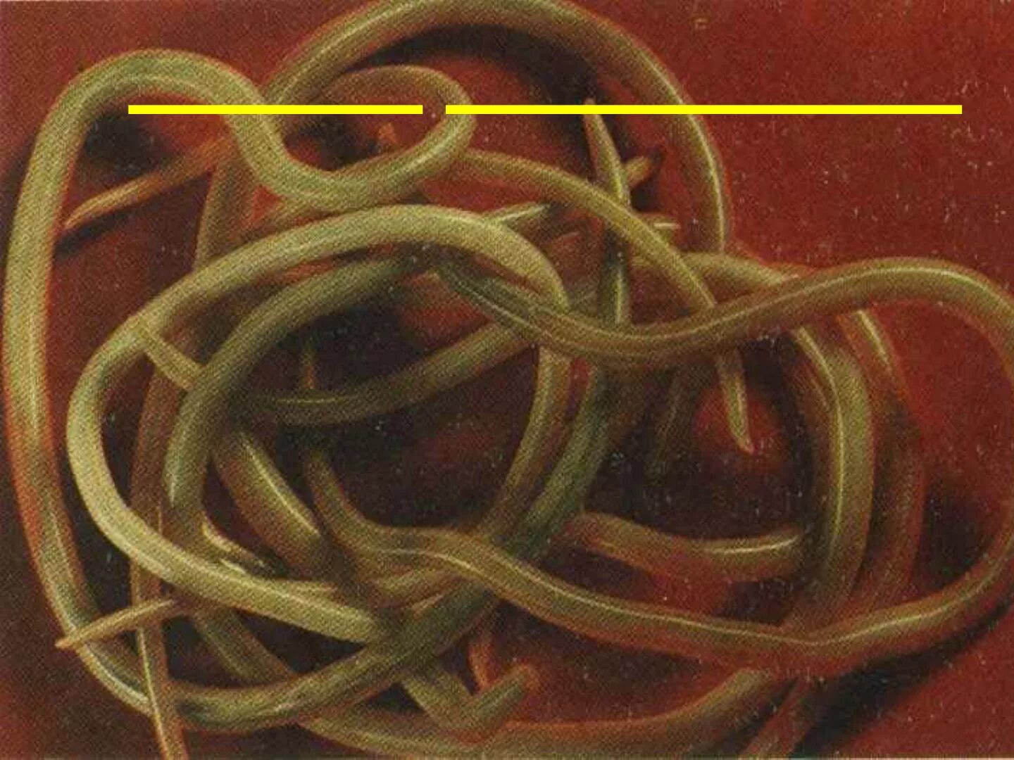 В какой среде обитает червь паразит. Паразиты черви аскариды. "Аскарида" человеческая гельминт. Геогельминтозы (аскаридоз).