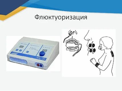 Флюктуоризация