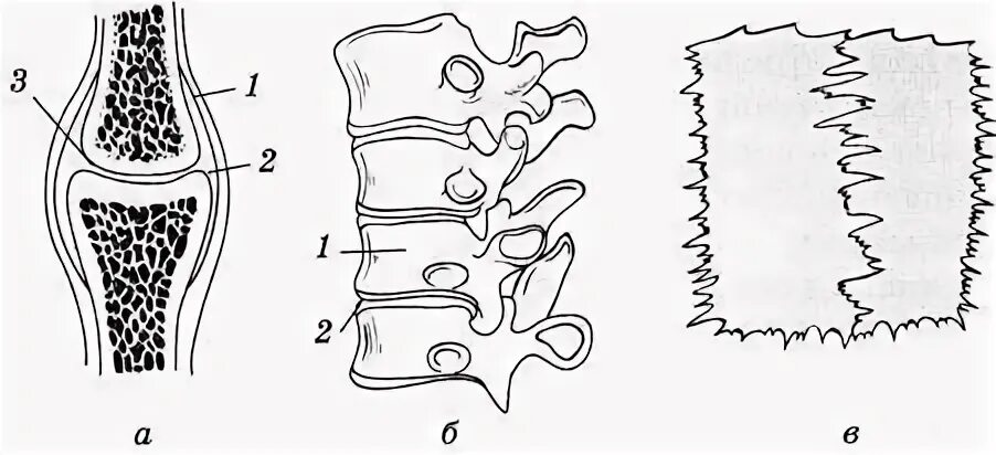 Костные пластинки грубоволокнистой костной ткани. Костная ткань. Костная ткань в соединительной ткани человека. Строение клетки костной ткани. Клетки косьевой ткаени.