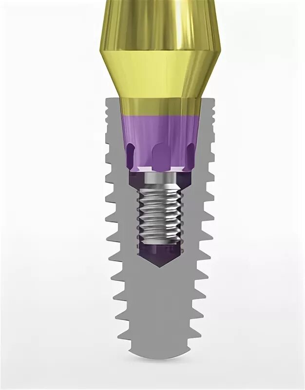 Импланты mis 7 seven. Southwest michigan dating. Mis first. Microvast, inc. First credit logo.