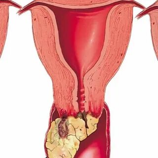Харьковтағы жұтылумен минет