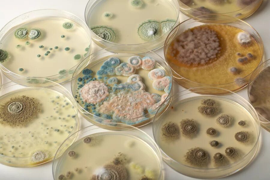 Микроорганизмы в пищевой промышленности. Микотоксины плесневых грибов. Bacillus subtilis на чашке Петри. Микотоксикозы микробиология. Штамм Bacillus subtilis колония.
