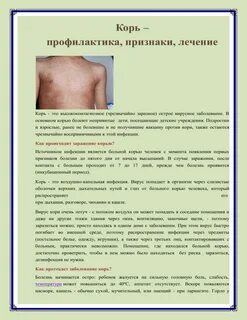 Как лечить корь