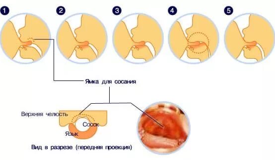 Акт сосания. Правильное прикладывание ребенка при грудном вскармливании. Как правильно прикладывать ребенка для кормления новорожденного. Правильное прикладывание к груди. Как правильно кормить новорожденного грудью.