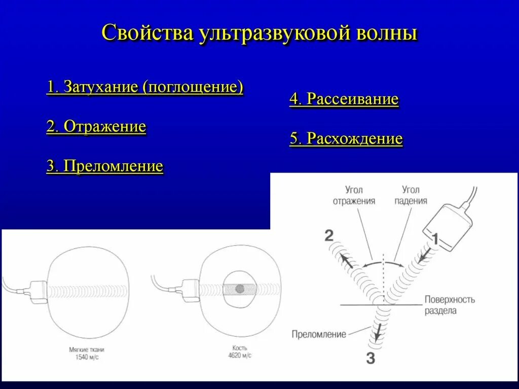 Особенности распространения ультразвуковых волн. Особенности ультразвука. Физические характеристики ультразвука. Свойства ультразвука кратко. Свойства ультразвуковых волн.