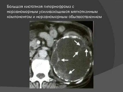 Диагностика кист