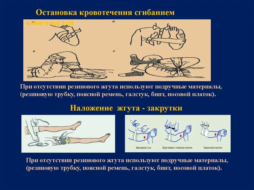 Остановка кровотечения с помощью жгута. Максимальное сгибание конечности для остановки кровотечения. Остановка кровотечения методом максимального сгибания конечности. Жгут трубка резиновый остановка кровотечения.