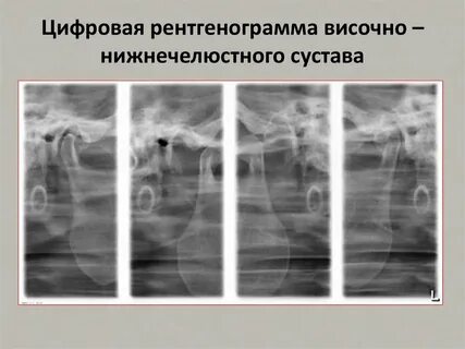 Зонография