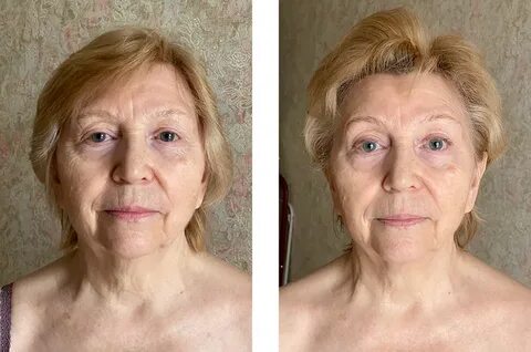 Скульптурный массаж до и после