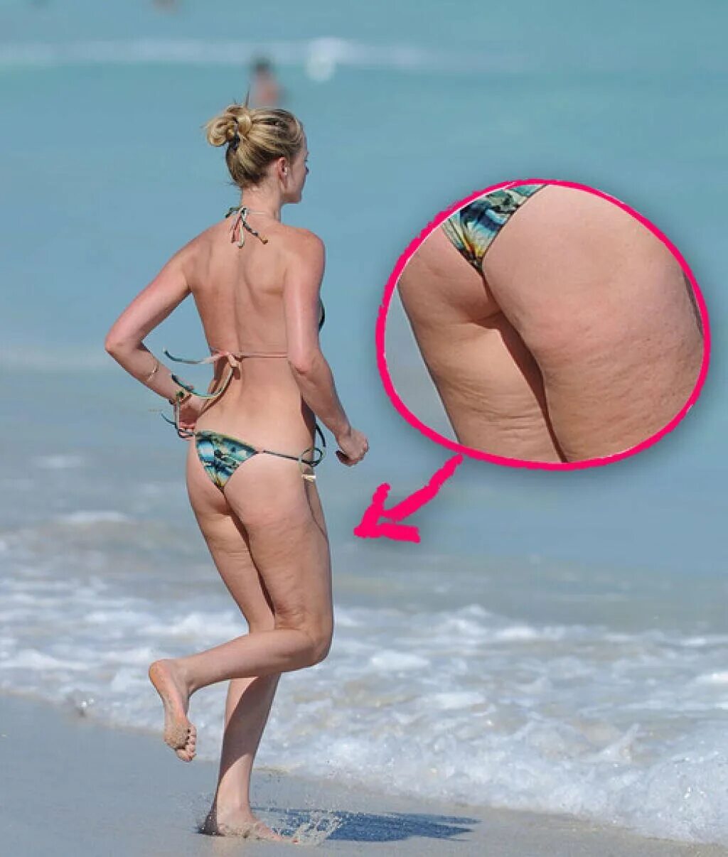 Целлюлит у худых девушек. Целлюлит у худых девушек. Кейт мосс целлюлит. Целлюлит у стройных девушек. Скарлетт йоханссон целлюлит 2022.