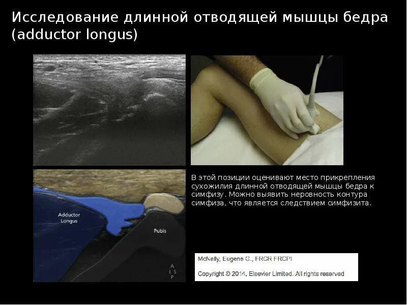 Где сделать узи тазобедренного сустава. Узи тазобедренного сустава. узи тазобедренного сустава область воздействия. узи бедренного сустава. узи тазобедренного сустава у взрослых.