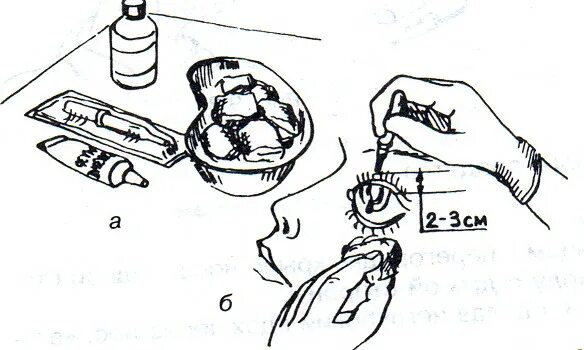 Закапывание капель детям алгоритм. Алгоритм закапывания капли в глаза. Алгоритм закапывания капель в глаза пациенту. Закапывание капель в нос детям алгоритм. Алгоритм закапывания капель в глаза, нос..