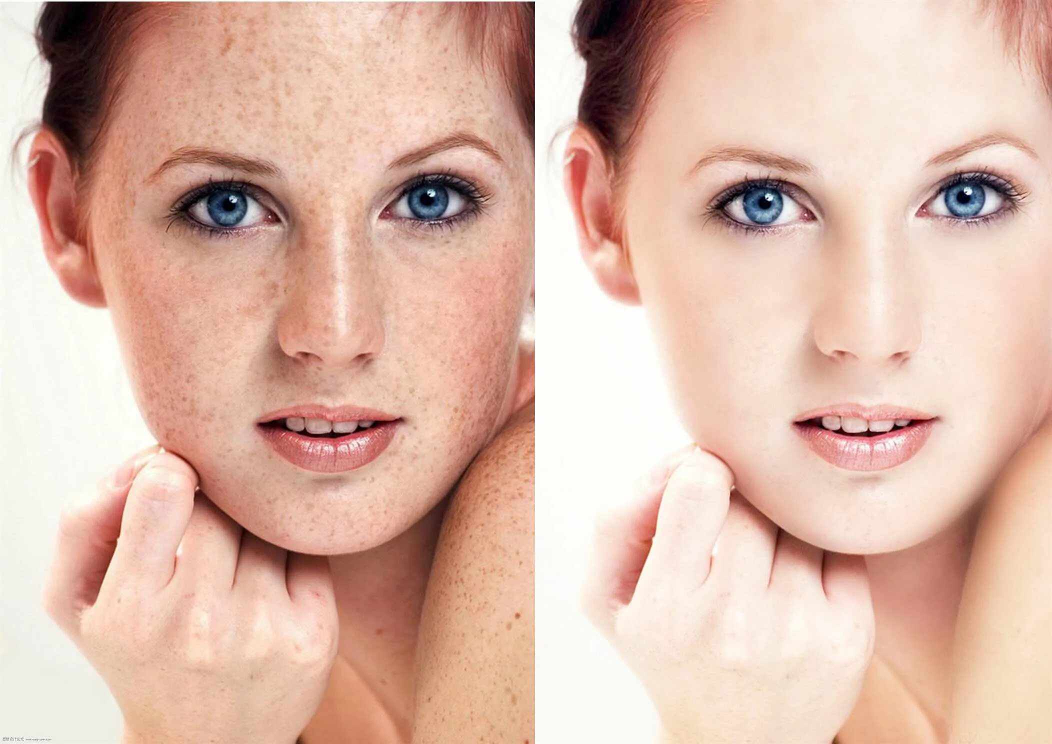 Почему появляется эффект. Пигментация на лице до и после. Веснушки на лице. Отбеливание кожи.