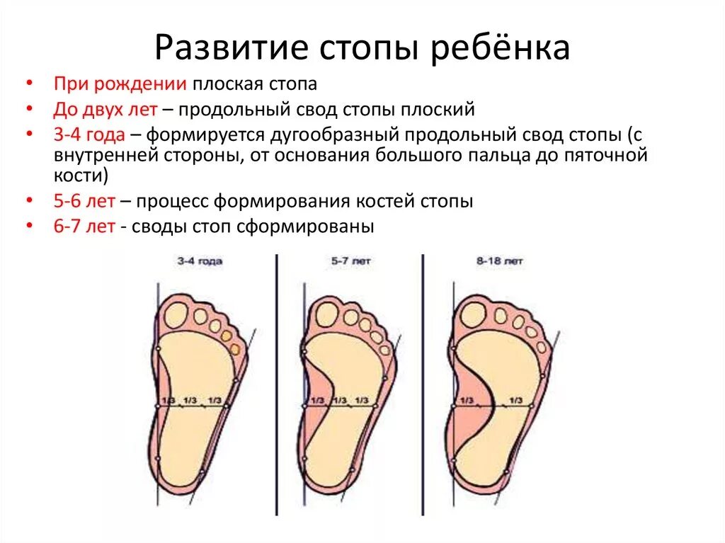 Быстро растет стопа. Плоскостопие у ребенка 3 года стопа. Формирование стопы у ребенка. Плоская стопа у ребенка 5 лет. Плоскостопие 2-3 степени вальгус.